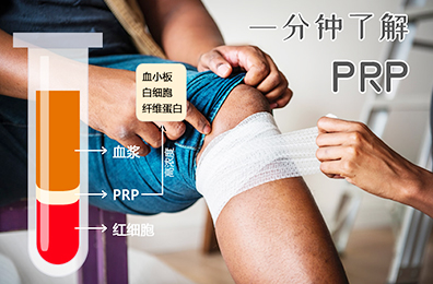 PRP综合介绍